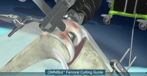 OMNIBotics robot műtét