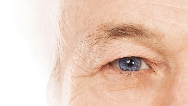 Szemhéjkorrekció vagy szemhéjplasztika